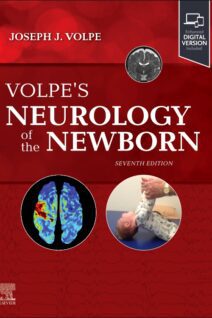Volpe's Neurology of the Newborn
