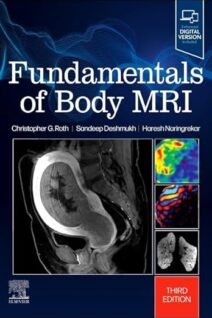 Fundamentals of Body MRI