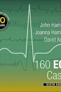 160 ECG Cases