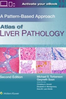 Atlas of Liver Pathology: A Pattern-Based Approach