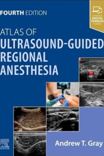 Atlas of Ultrasound-Guided Regional Anesthesia