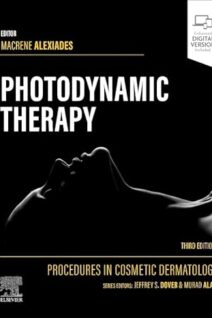 Procedures in Cosmetic Dermatology Series: Photodynamic Therapy