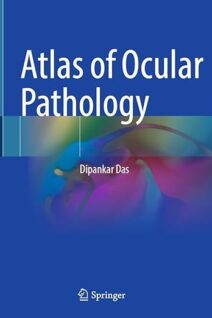 Atlas of Ocular Pathology 