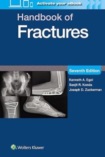 Handbook of Fractures