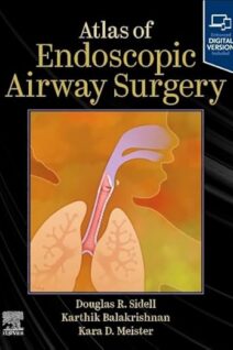 Atlas of Endoscopic Airway Surgery