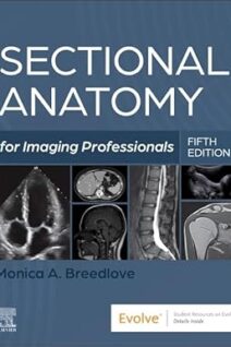 Sectional Anatomy for Imaging Professionals