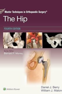 Master Techniques in Orthopaedic Surgery: The Hip