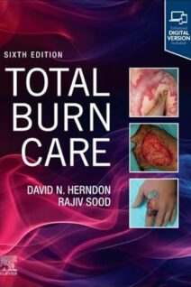 Total Burn Care