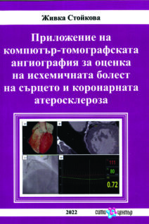 Приложение на компютър-томографската ангиография за оценка на исхемичната болест на сърцето и коронарната ателосклероза