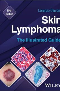 Skin Lymphoma The Illustrated Guide