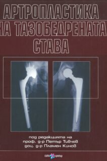 Артропластика на тазобедрената става