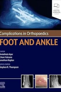 Complications in Orthopaedics: Foot and Ankle