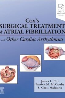 Cox’s Surgical Treatment of Atrial Fibrillation