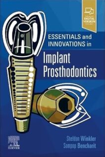 Essentials and Innovations in Implant Prosthodontics
