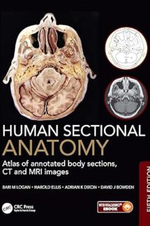 Human Sectional Anatomy Atlas of Body Sections Ct and MRI Images