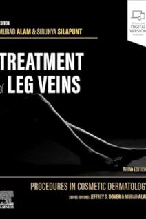 Procedures in Cosmetic Dermatology Series Treatment of Leg Veins