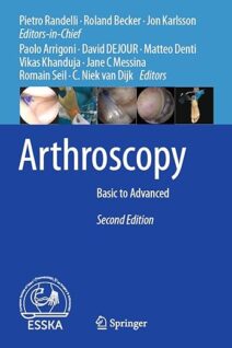Arthroscopy Basic to Advanced 