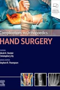 Complications in Orthopaedics: Hand Surgery