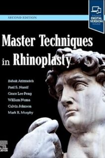 Master Techniques in Rhinoplasty