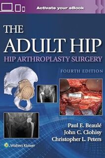 The Adult Hip Hip Arthroplasty Surgery