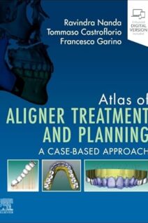 Atlas of Aligner Treatment and Planning