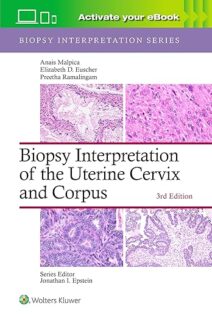 Biopsy Interpretation of the Uterine Cervix and Corpus
