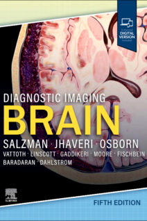 Diagnostic Imaging Brain