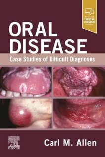 Oral Disease: Case Studies of Difficult Diagnoses